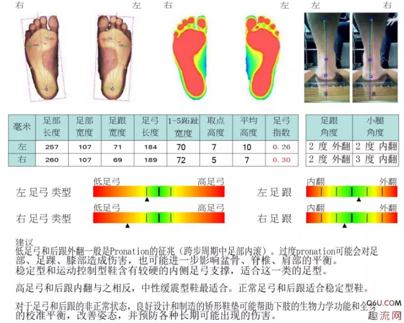 3d打印鞋垫多少钱一双 3d打印鞋垫效果好吗