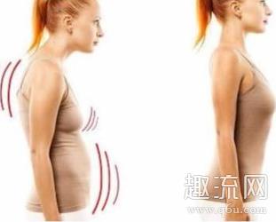 驼背能治好吗 驼背如何矫正