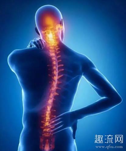 脊柱侧弯是什么意思 脊柱侧弯如何矫正