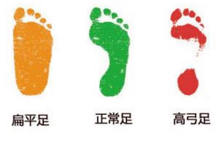 扁平足为什么不能跑步 扁平足为什么不能打篮球