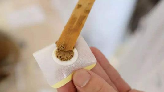 三伏贴第二天可以不用忌口吗(三伏贴忌口什么)