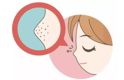 为什么长黑头毛孔粗大(怎么去黑头不扩大毛孔)