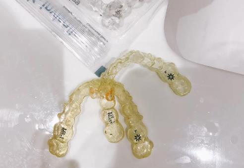 牙套咖喱染色多久可以退掉（戴牙套期间适合吃什么）