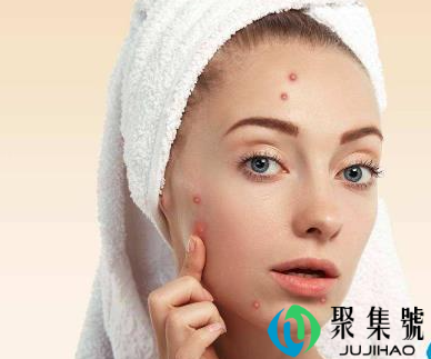 下巴长痘痘是什么原因(下巴长痘有没有治疗的方法)