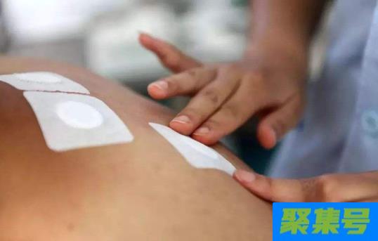 贴三伏贴痒好还是不痒好