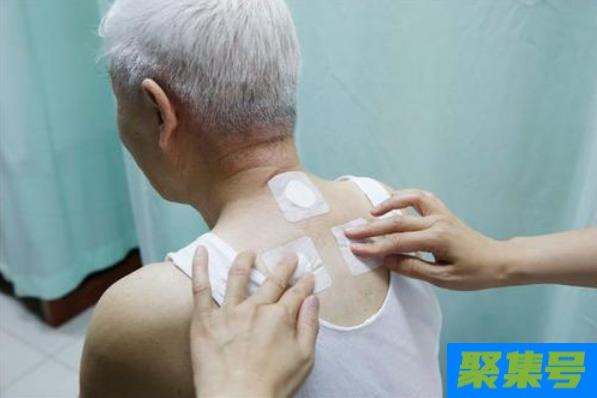 三伏贴挂理疗科还是康复科
