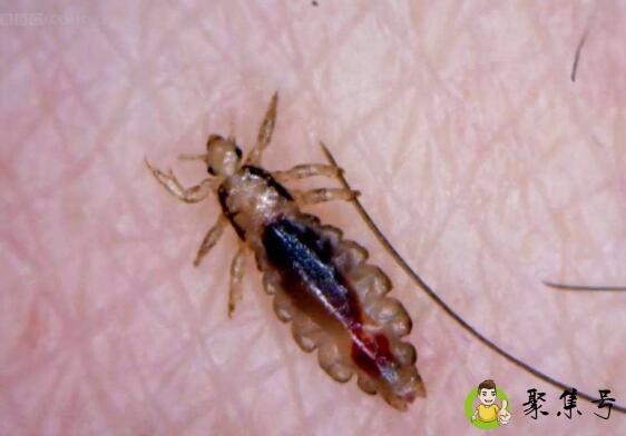 虱子怕什么味道