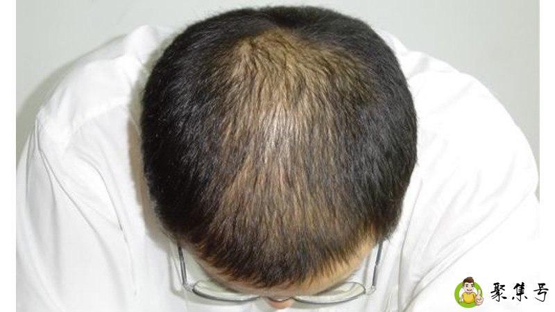 雄脱是什么意思