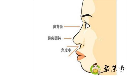 蒙古人种有什么特征