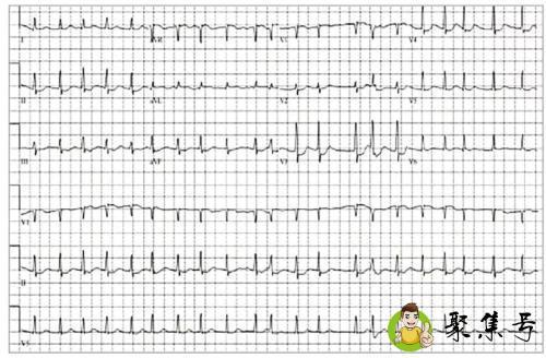 详细阅读:心侓不齐是什么意思 心侓不齐是什么意思