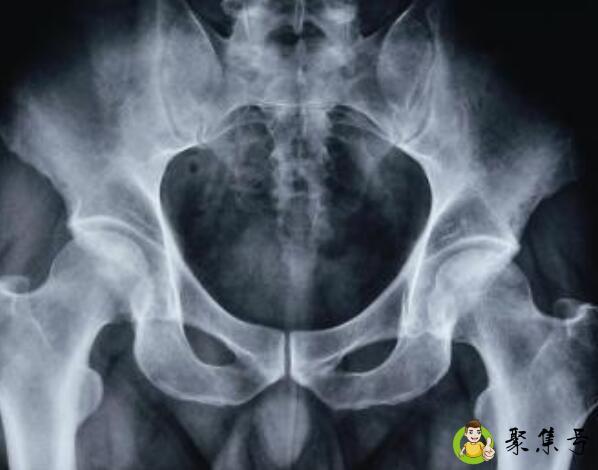 股骨头位置在哪个部位