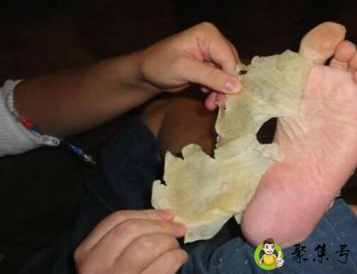 去脚皮的方法