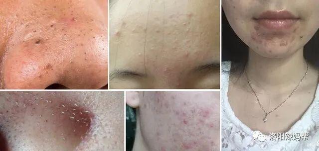 宝妈想挣钱有什么门路（适合宝妈在家用手机做的兼职）