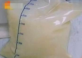 乳糜血是什么意思(乳糜血是什么意思吃什么消除快)