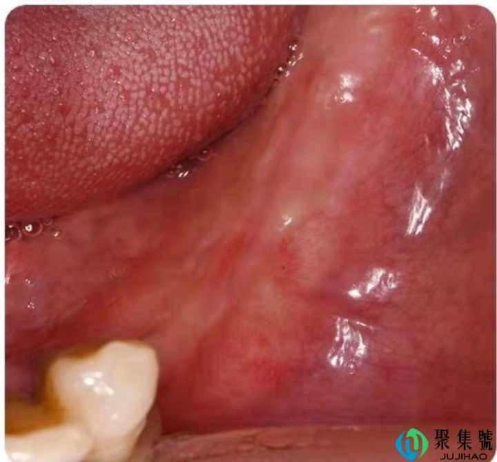 北京种植牙去哪里?该怎么选