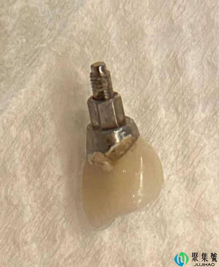 北京种植牙去哪里?该怎么选