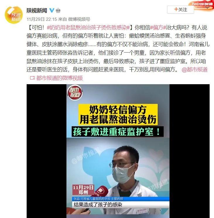 老鼠油可以治烫伤吗(老鼠油治烫伤效果好吗留疤吗)