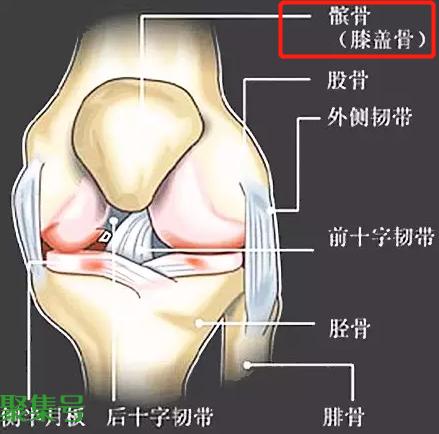髌骨是哪个部位(髌骨软化症是怎么回事)