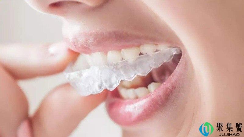 隐形牙套怎么清洗