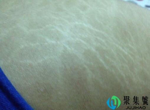 束带和胖纹的区别