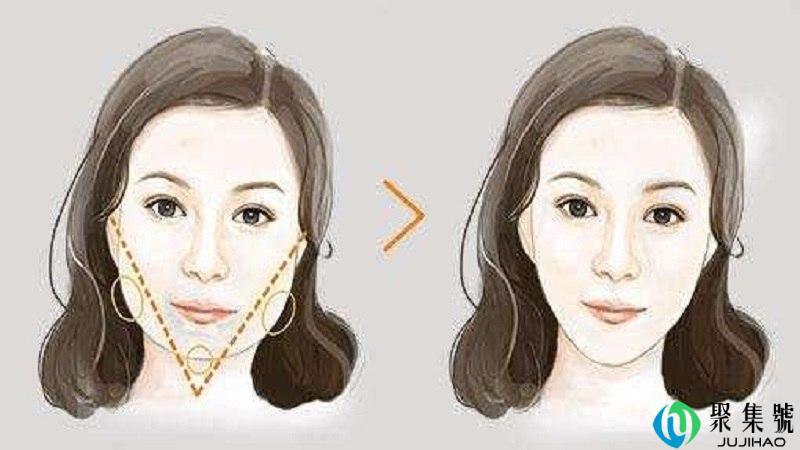 精致下颌什么意思