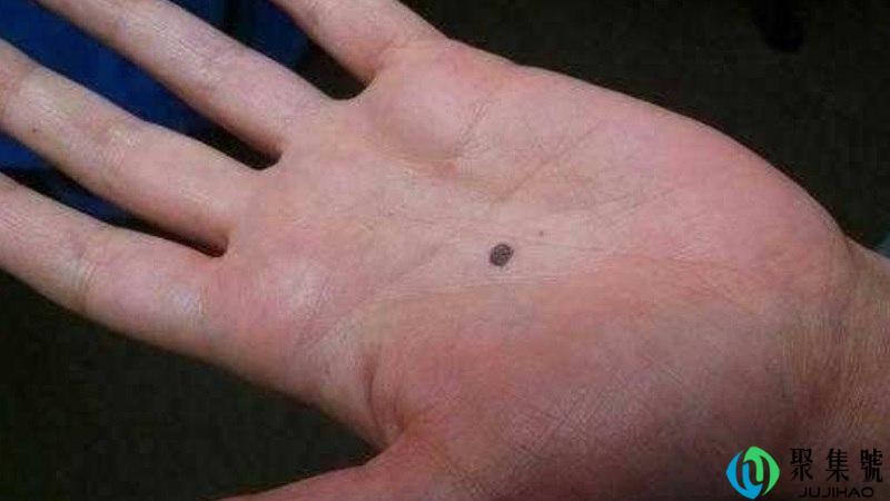 掌心画黑点什么意思