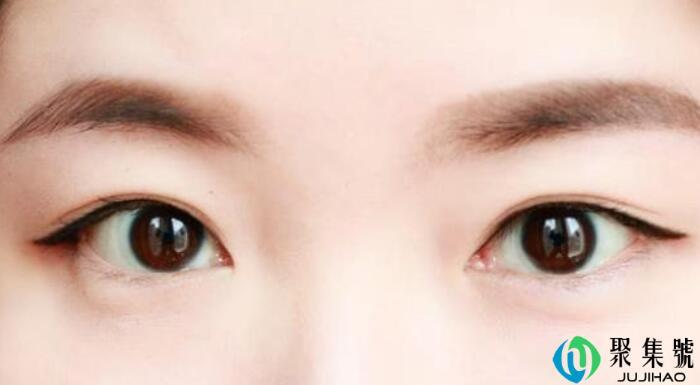 眼间距多少合适