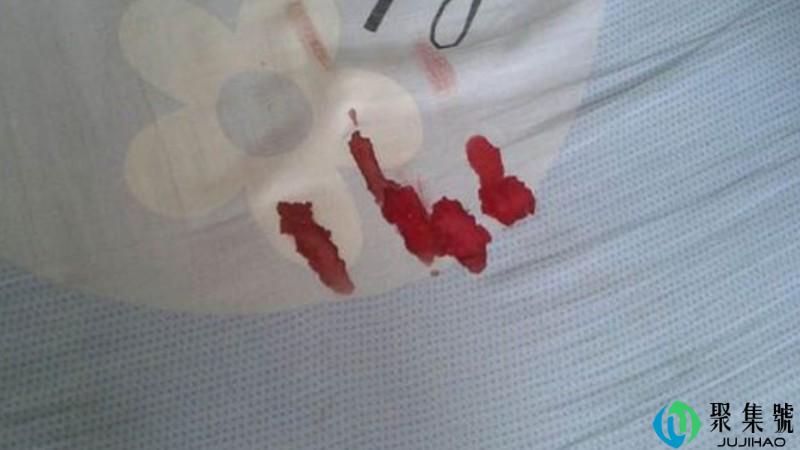 月经弄到床单上小妙招