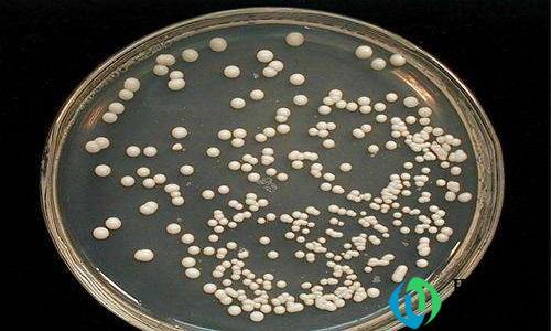 酵母菌是细菌还是真菌