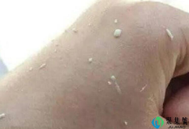 娇韵诗搓泥现象解决方法