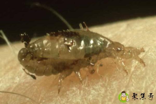 去除虱子卵最好小窍门