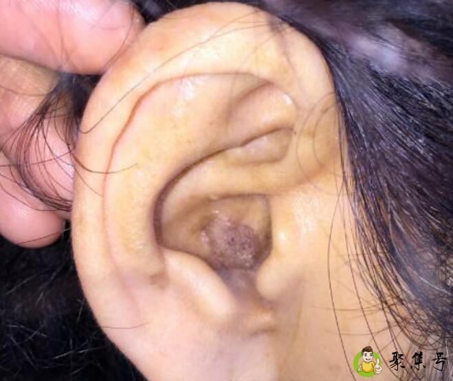 怎样清洗耳朵