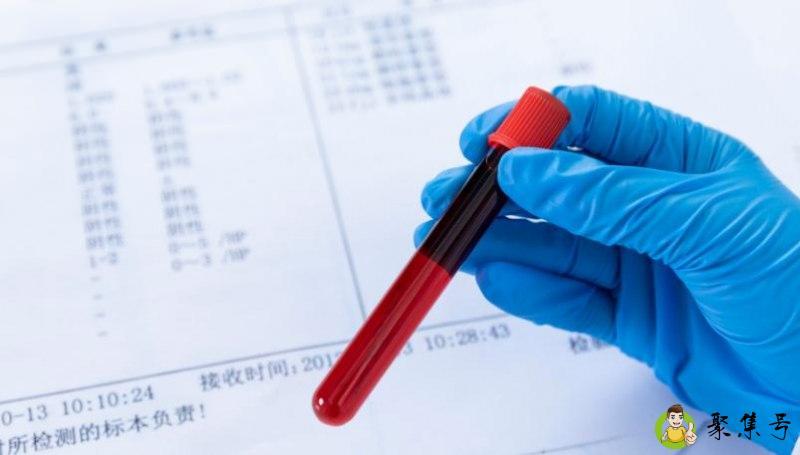 a型血为什么叫贵族血