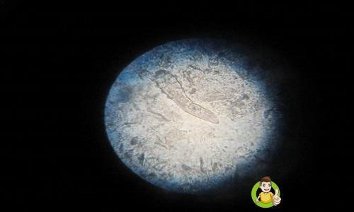 螨虫真的有那么可怕吗