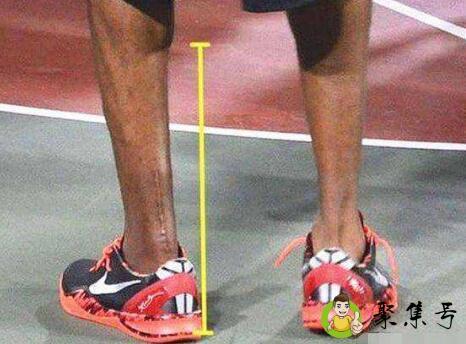 跟腱短的表现