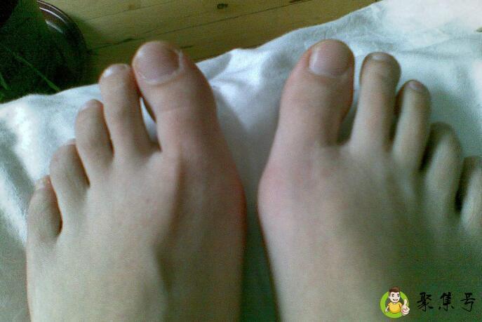 脚第二个脚趾长说法